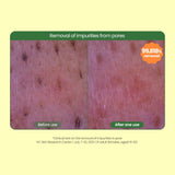 Dr.G Global DR.G GREEN DEEP PORE CLEAR FOAM (150ML)