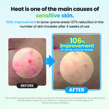 Dr.G Global Face Masks/Pads (NEW) DR.G R.E.D BLEMISH RADISH CICA ICYING PADS 60EA