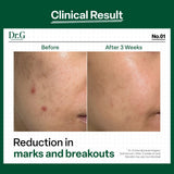 Dr.G Global Skincare DR.G R.E.D BLEMISH REPAIR SOOTHING CREAM (50ML)