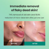 Dr.G Global Exfoliators DR.G BRIGHTENING PEELING GEL (120G)