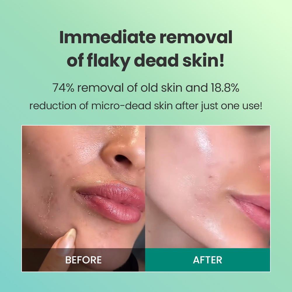 Dr.G Global Exfoliators DR.G BRIGHTENING PEELING GEL (120G)