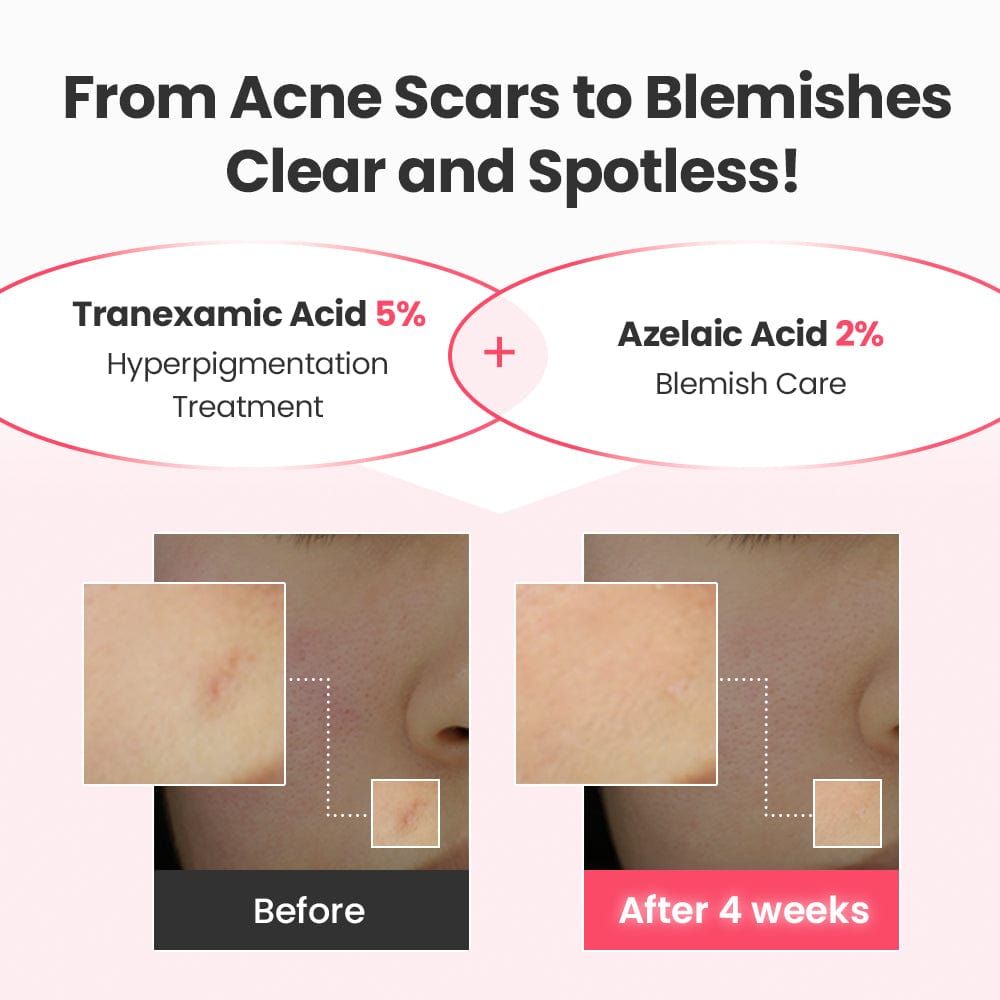 Dr.G Global Serums/Essence DR.G R.E.D BLEMISH TXA REPAIR SERUM (30ML)