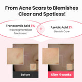 Dr.G Global Serums/Essence DR.G R.E.D BLEMISH TXA REPAIR SERUM (30ML)