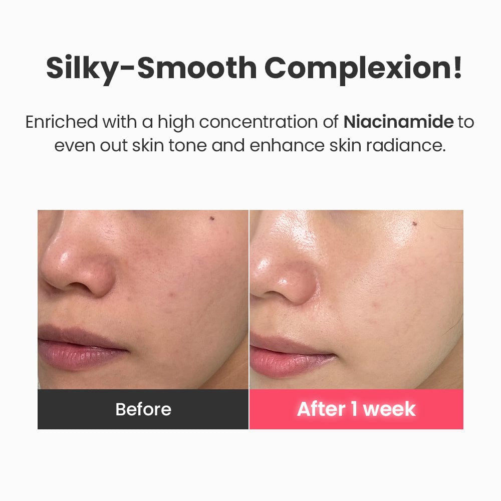 Dr.G Global Serums/Essence DR.G R.E.D BLEMISH TXA REPAIR SERUM (30ML)