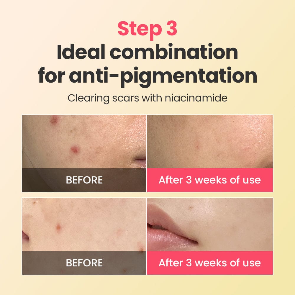 Dr.G Global Skincare DR.G R.E.D BLEMISH REPAIR SOOTHING CREAM (50ML)