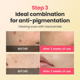 Dr.G Global Skincare DR.G R.E.D BLEMISH REPAIR SOOTHING CREAM (50ML)