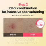 Dr.G Global Skincare DR.G R.E.D BLEMISH REPAIR SOOTHING CREAM (50ML)
